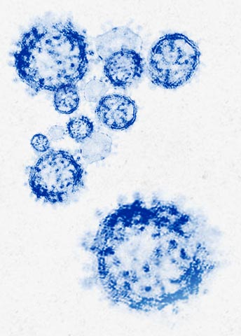 COVID_19_BLUE_356x480